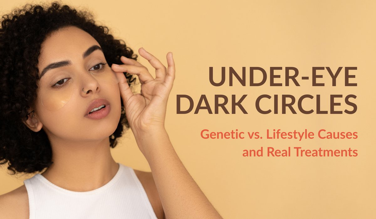 Under-Eye Dark Circles - Genetic vs. Lifestyle Causes and Real Treatments